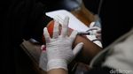 Ratusan Orang Ikut Hapus Tato Gratis di Kantor Walikota Jakarta Timur