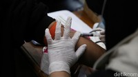 Kemudian, peserta juga perlu di anestesi sebelum pelaksanaan hapus tato itu dengan krim antikebas.  