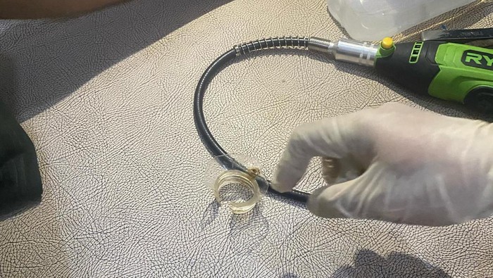 Penampakan bagian leher botol yang tersangkut di alat kelamin remaja laki-laki saat ditangani Damkar Wonogiri, Selasa (18/3/2025).