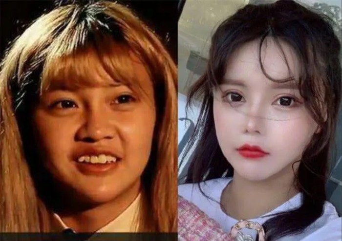 Influencer operasi hidung