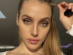 Foto: Kondisi Model OnlyFans yang Hilang Ingatan Setelah Kecelakaan Motor