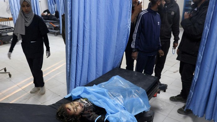 SENSITIVE MATERIAL. THIS IMAGE MAY OFFEND OR DISTURB    A Palestinian casualty lies on a mattress at the Indonesian hospital following an Israeli strike, in the northern Gaza Strip March 19, 2025. REUTERS/Abd Elhkeem Khaled