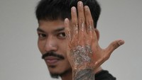 Jika penghapusan tato tidak mungkin atau membahayakan, maka cukup dengan taubat nasuha (taubat yang tulus) dan banyak istighfar.   