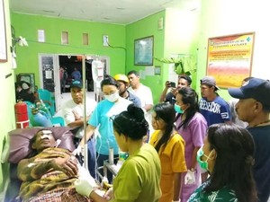 Warga Flores Timur Melepuh Akibat Kena Lahar Panas Lewotobi