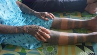 Tato bangsawan melingkar di pergelangan kaki dan tangan Lem Dungau