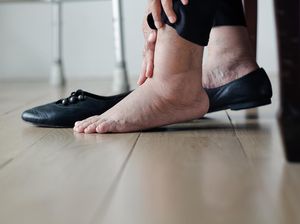Tanda-tanda Punya Masalah Jantung-Liver yang Bisa Terlihat di Kaki