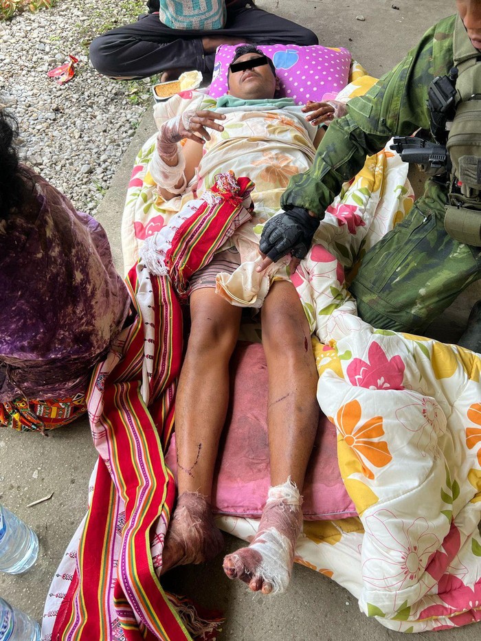 Seorang guru tewas dan 6 guru lainnya terluka diserang OPM di Yahukimo, Papua Pegunungan. Korban tewas dan luka-luka telah dievakuasi prajurit TNI.