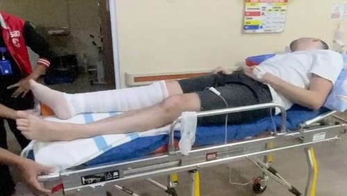 WN Dubai, Ahmed Samy Niazy Elgharably digigit ular berbisa saat menginap di Novotel Hotel, Kuta Lombok. (Dok. Bayu Perdana, kuasa hukum korban)