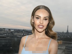 Foto: Artis yang Jadi Korban Air Keras Pamer Skin Confidence