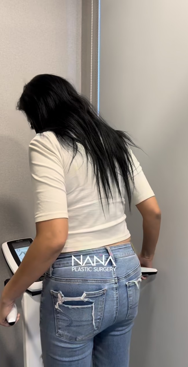 Tak hanya bagian wajah, bagian tubuh Asri juga turut jalani oplas. Terlihat momen awal saat Asri tengah menimbang bobot tubuhnya. Foto: Instagram/@nanahospital.id