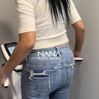 Tak hanya bagian wajah, bagian tubuh Asri juga turut jalani oplas. Terlihat momen awal saat Asri tengah menimbang bobot tubuhnya. Foto: Instagram/@nanahospital.id