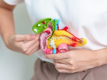 Nyaris 100 Batu Empedu Dikeluarkan dari Perut Wanita China, Ini Jadi Biang Keroknya