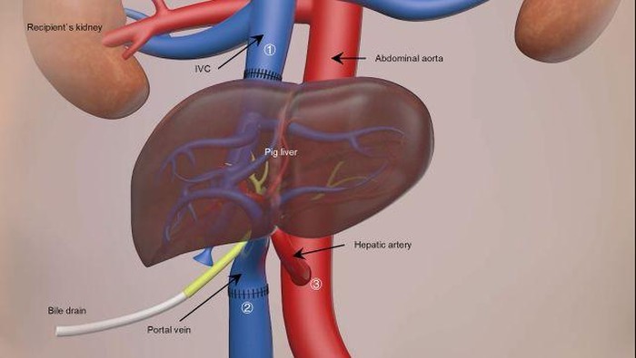 Ilmuwan China Transplantasi Hati Babi ke Manusia, Hidup 171 Hari!
