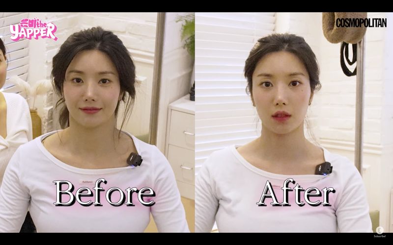 Prosedur kecantikan yang dilakukan Kwon Eunbi jelang comeback