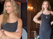 Heboh Wanita Tangannya Besar Sebelah Sejak Kecil, Ternyata Idap Kondisi Langka Ini