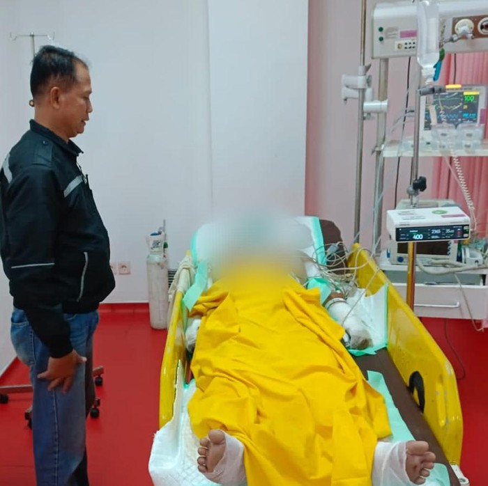 Empat Remaja di Tulungagung Alami Luka Bakar Saat Produksi Petasan