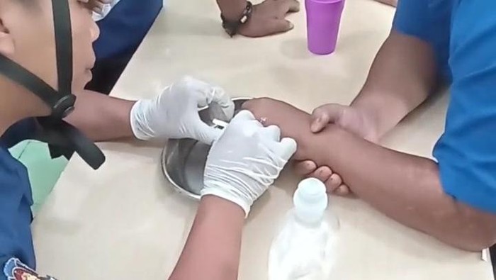 Cincin pria Tasikmalaya tak bisa lepas dan meminta pertolongan Damkar.