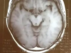 Awas Terkecoh dengan Deretan Foto Ini, Lihat Dua Kali Biar Tak Keliru