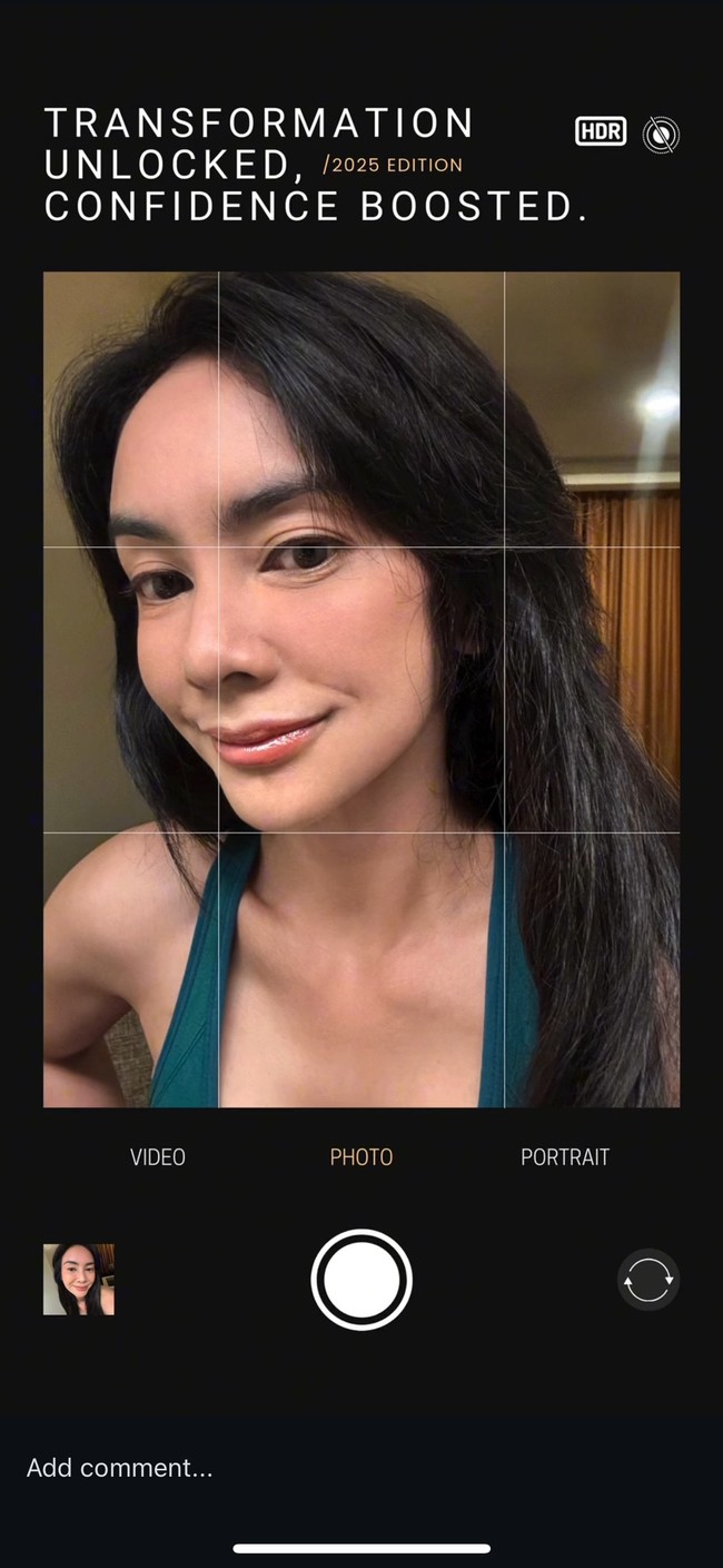 Sesuai dengan tujuan oplasnya, wajah Masayu kini juga terlihat lebih bervolume dibanding sebelumnya. Penampilannya kini pun jadi makin awet muda. Foto: Instagram/@_irishbella_