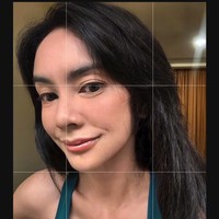 Sesuai dengan tujuan oplasnya, wajah Masayu kini juga terlihat lebih bervolume dibanding sebelumnya. Penampilannya kini pun jadi makin awet muda. Foto: Instagram/@_irishbella_