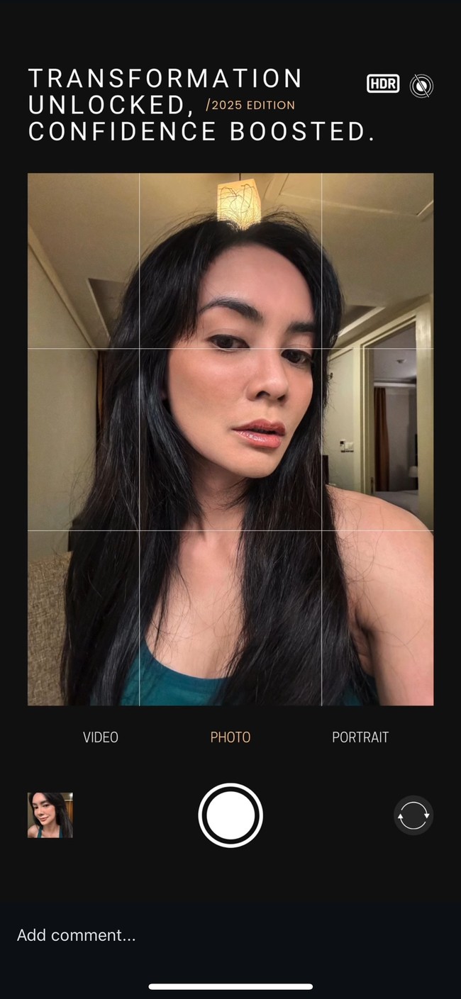 Diakui Masayu dalam foto tersebut wajahnya memang masih sedikit bengkak namun hal itu wajar karena masih dalam proses pemulihan pasca oplas. Foto: Instagram/@_irishbella_