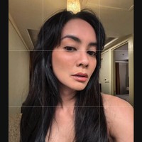 Diakui Masayu dalam foto tersebut wajahnya memang masih sedikit bengkak namun hal itu wajar karena masih dalam proses pemulihan pasca oplas. Foto: Instagram/@_irishbella_