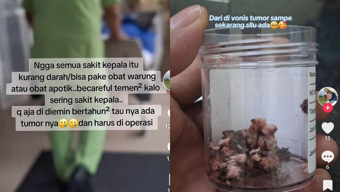 Viral wanita di Pemalang mengeluh sakit kepala, ternyata mengidap tumor otak.