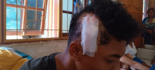 Siswa SMKN 1 Komodo, Labuan Bajo, Manggarai Barat, NTT, menjadi korban pembacokan orang tak dikenal, Sabtu (5/4/2025) dini hari. (Istimewa)