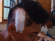 Pelajar Dikeroyok-Dibacok di Puncak Waringin Labuan Bajo, Kepala-Bahu Luka