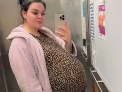 Perut Wanita Ini Sangat Besar Sampai Dikira Hamil 4 Anak, Ternyata..