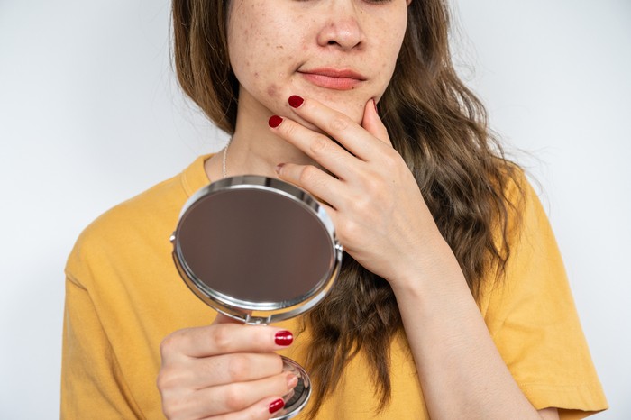 Wajah Gatal Setelah Pakai Skincare Wajah Gatal Setelah Pakai Skincare