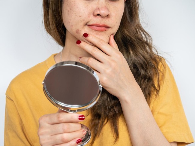 Wajah Gatal Setelah Pakai Skincare Wajah Gatal Setelah Pakai Skincare