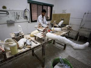 Tempat Ini Sediakan Kaki Palsu untuk Warga Gaza Korban Serangan Israel