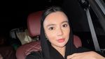 Penampilan Terbaru Wika Salim Usai Oplas