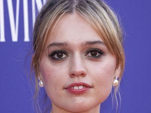 7 Selebriti dengan Senyum Imperfect yang Justru Bikin Terpesona