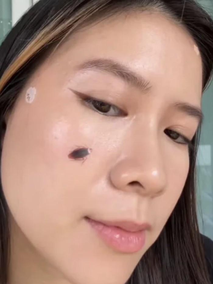 Acne patch bentuk kecoa