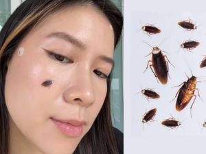Bikin Merinding! Ada Acne Patch Bentuk Kecoa, Tampilannya Realistis