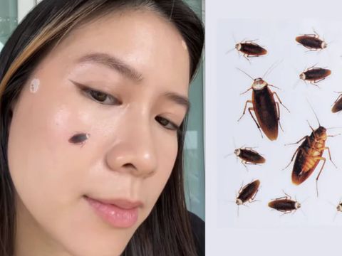 Acne patch bentuk kecoa