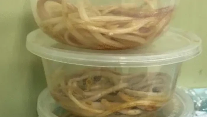 Cacing hidup di perut bocah 3 tahun di Jatim