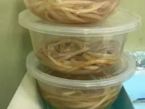 Video: Penampakan Cacing di Usus Bocah 3 Tahun di Jember