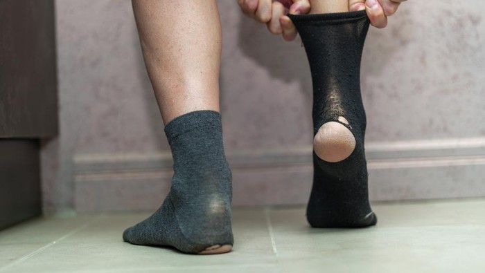 Awal Mula Pria China Kena Infeksi Jamur Paru, Punya Kebiasaan Cium Kaus Kaki Kotor