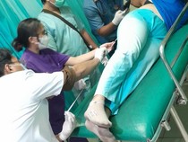 Perempuan Buleleng Jadi Korban Penembakan, Pelaku Masih Misterius