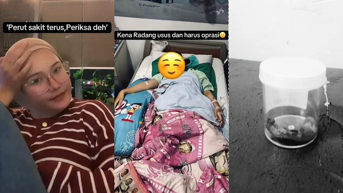 Wanita bogor idap radang usus buntu