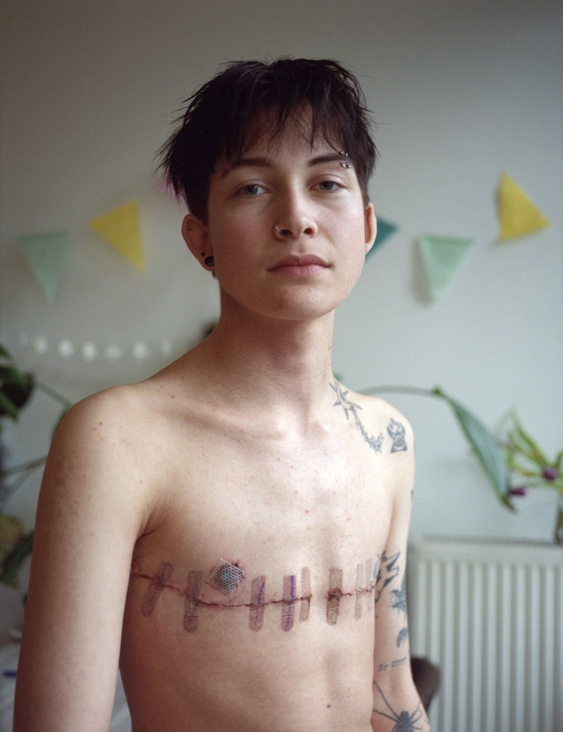 World Press Photo 2025