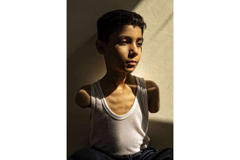 World Press Photo 2025