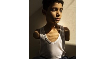 Kategori West, Central, and South Asia - Single. Karya Samar Abu Elouf, Palestina, The New York Times. Saat keluarganya mengungsi dari serangan Israel, Mahmoud berbalik untuk menyemangati yang lain, namun ledakan memutus satu lengannya dan melukai lengan lainnya. Dievakuasi ke Qatar, Mahmoud kini belajar main game, menulis, dan membuka pintu dengan kaki setelah perawatan medis. Mimpinya sederhana: mendapatkan prostetik dan hidup seperti anak lain. Perang sangat memengaruhi anak-anak. PBB memperkirakan pada Desember 2024, Gaza memiliki jumlah anak amputasi tertinggi per kapita di dunia.Fotografer dari Gaza, dievakuasi pada Desember 2023, tinggal di kompleks apartemen yang sama dengan Mahmoud di Doha. Ia menjalin ikatan dengan keluarga di sana dan mendokumentasikan beberapa warga Gaza yang terluka parah dan berhasil keluar untuk perawatan. Foto: World Press Photo