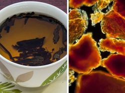 Mengejutkan! Begini Penampakan Benda Sehari-hari Dilihat Pakai Mikroskop