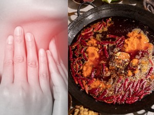 Ngeri! Wanita Ini Sakit Tenggorokan Berujung Tewas Usai Makan Hot Pot