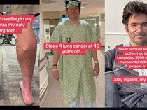 Pria Bugar 45 Tahun Kena Kanker Paru Stadium Akhir, Tak Punya Riwayat Merokok