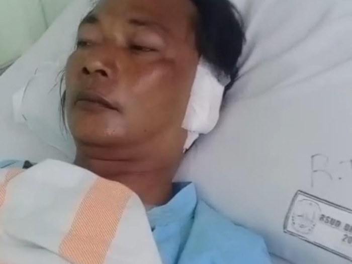 Telinga nelayan Pamekasan tertancap moncong ikan besar